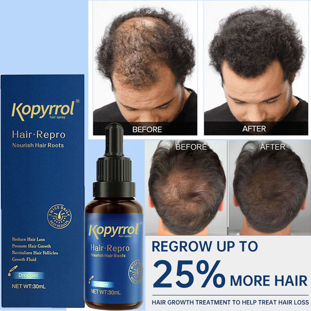 Fast Hair Growth Essence Oil Tonic for Men and Women 30ML