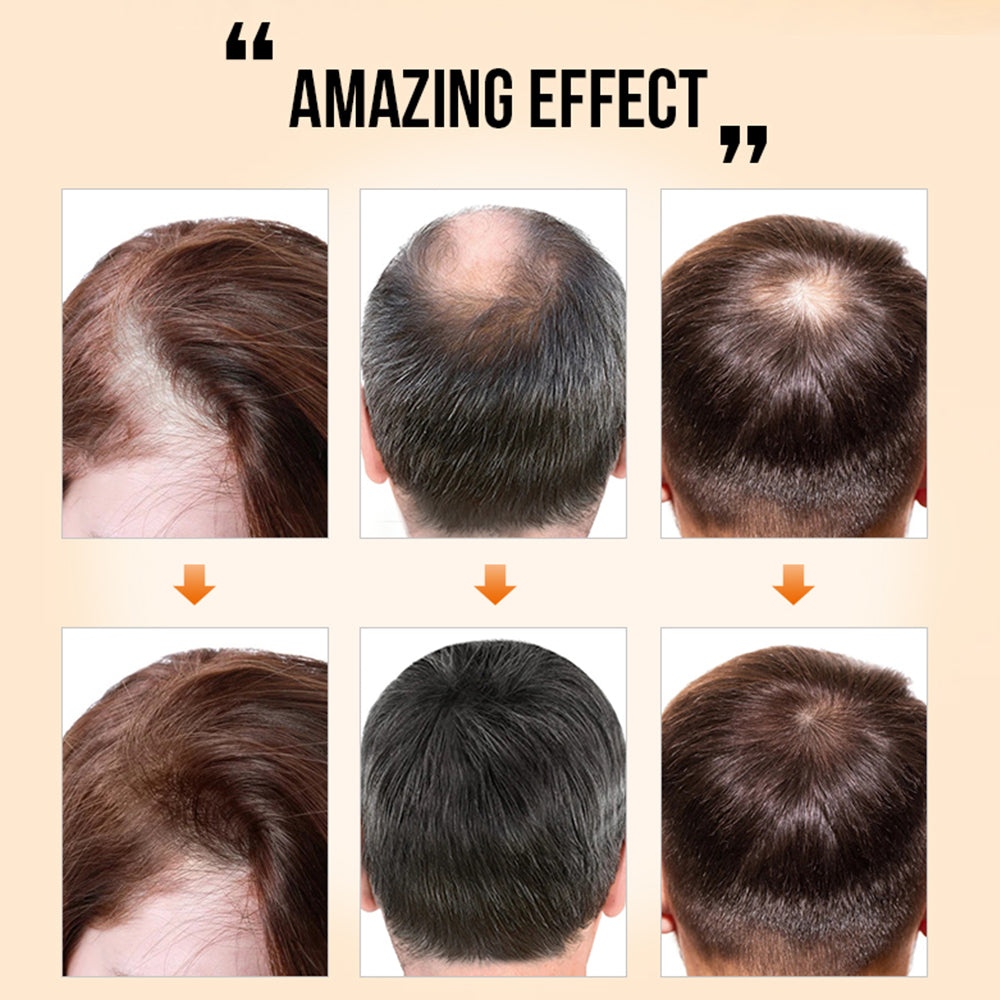 Fast Hair Growth Essence Oil Tonic for Men and Women 30ML